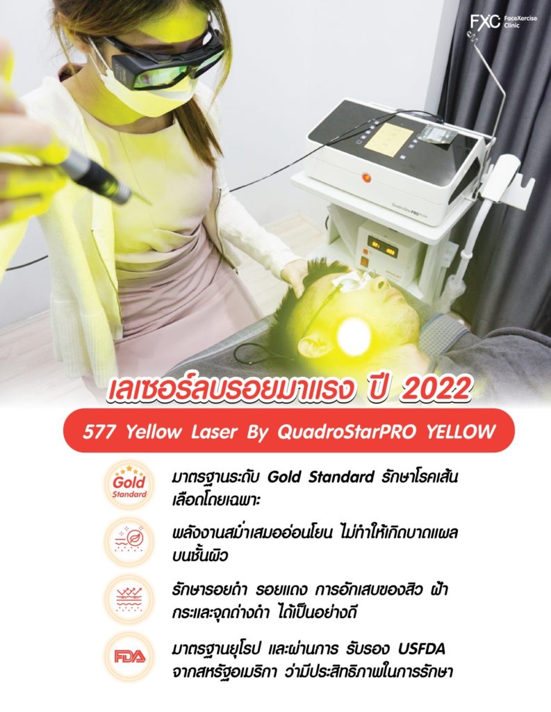577 Yellow Laser