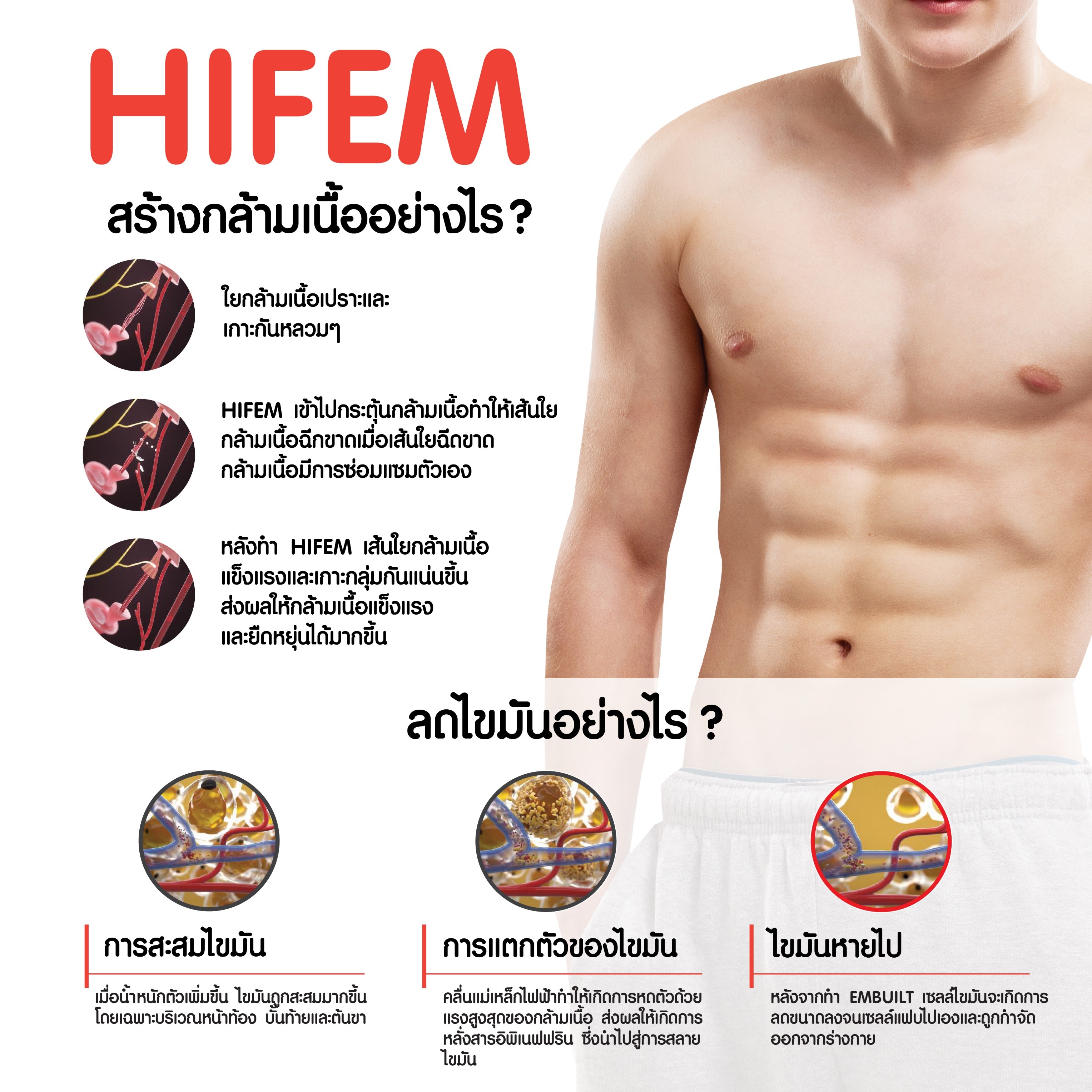 HIFEM สร้างกล้ามเนื้ออย่างไร_FXC_Thailand