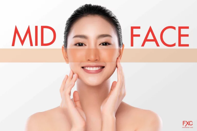 ผู้หญิงเอเชีย มีเส้นทาบบริเวณกลางใบหน้า(Midface)